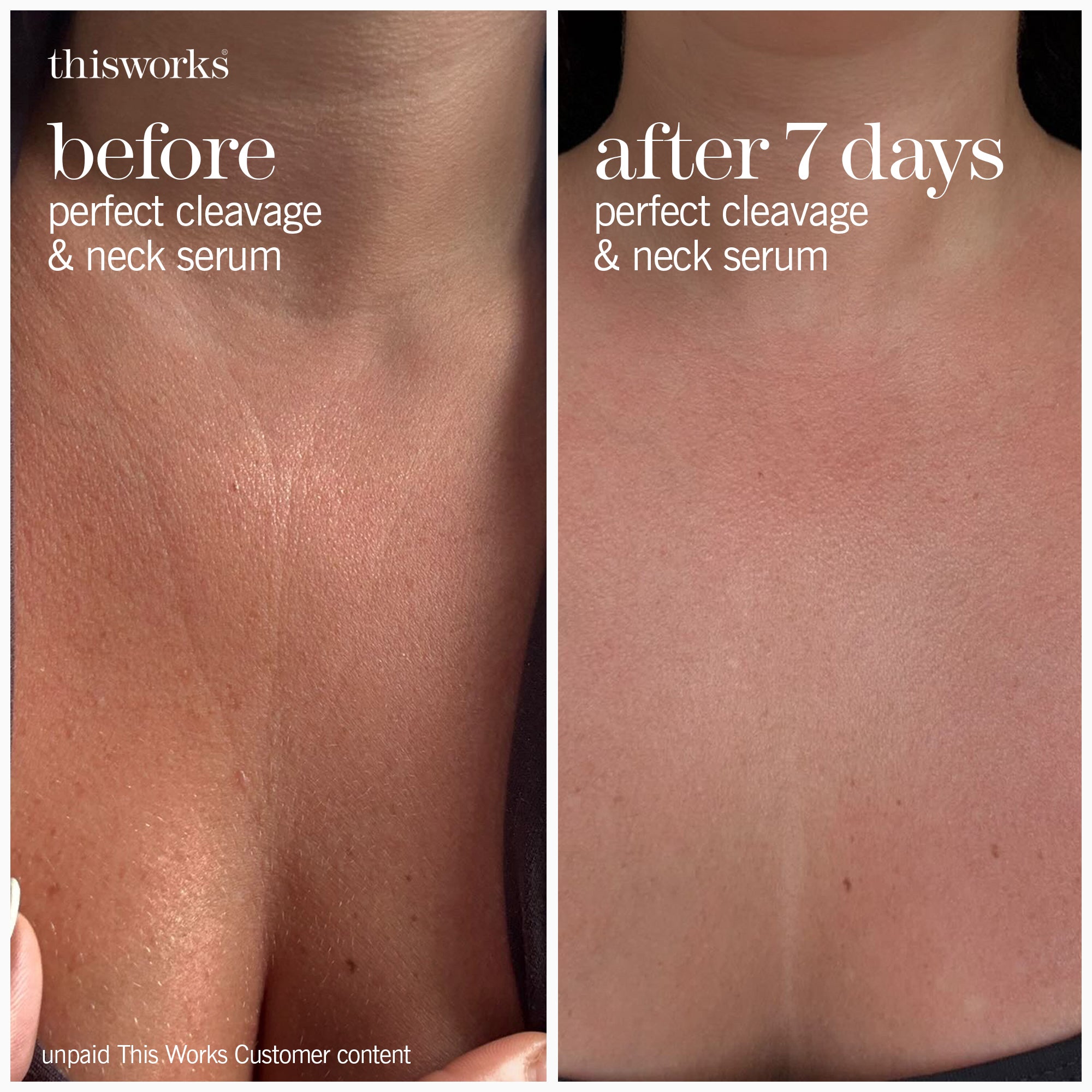 Perfect Cleavage & Neck Serum | Tightening Neck Cream | This