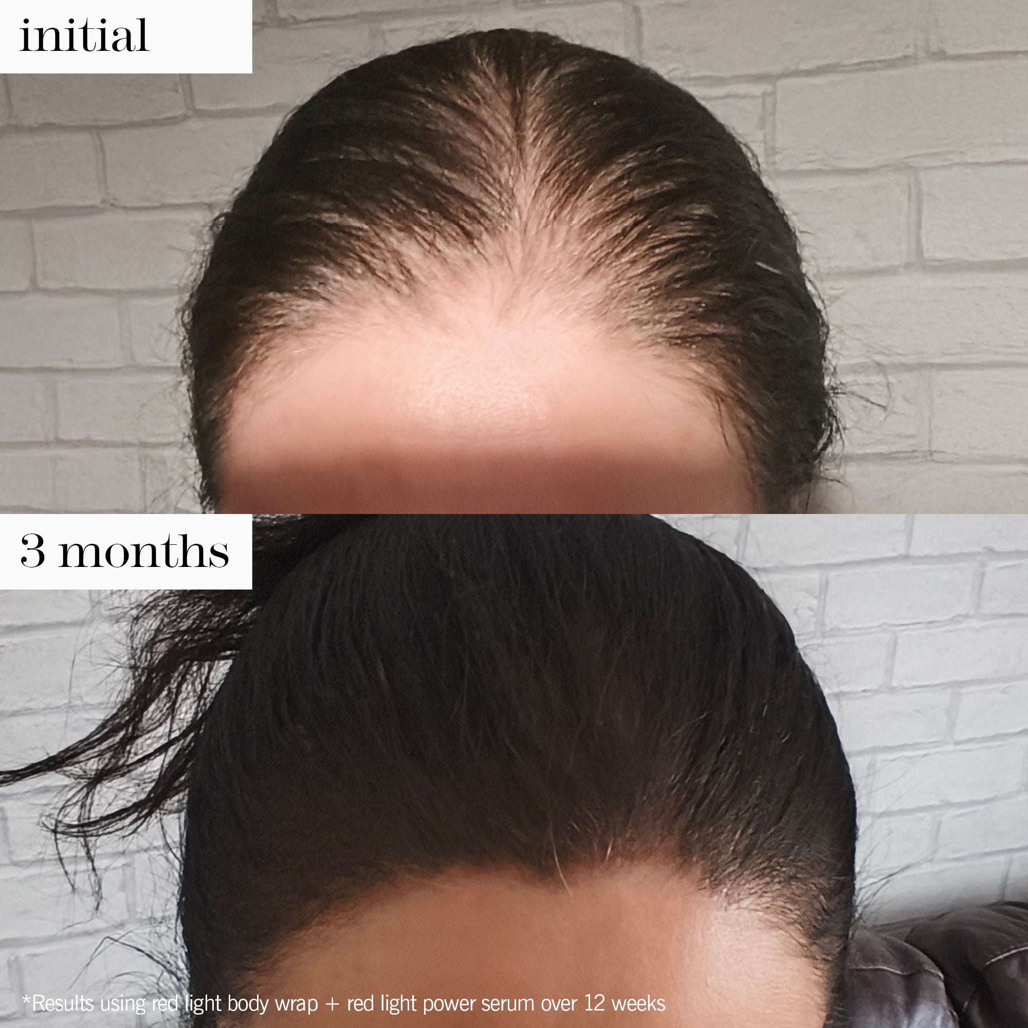 red light body wrap duo