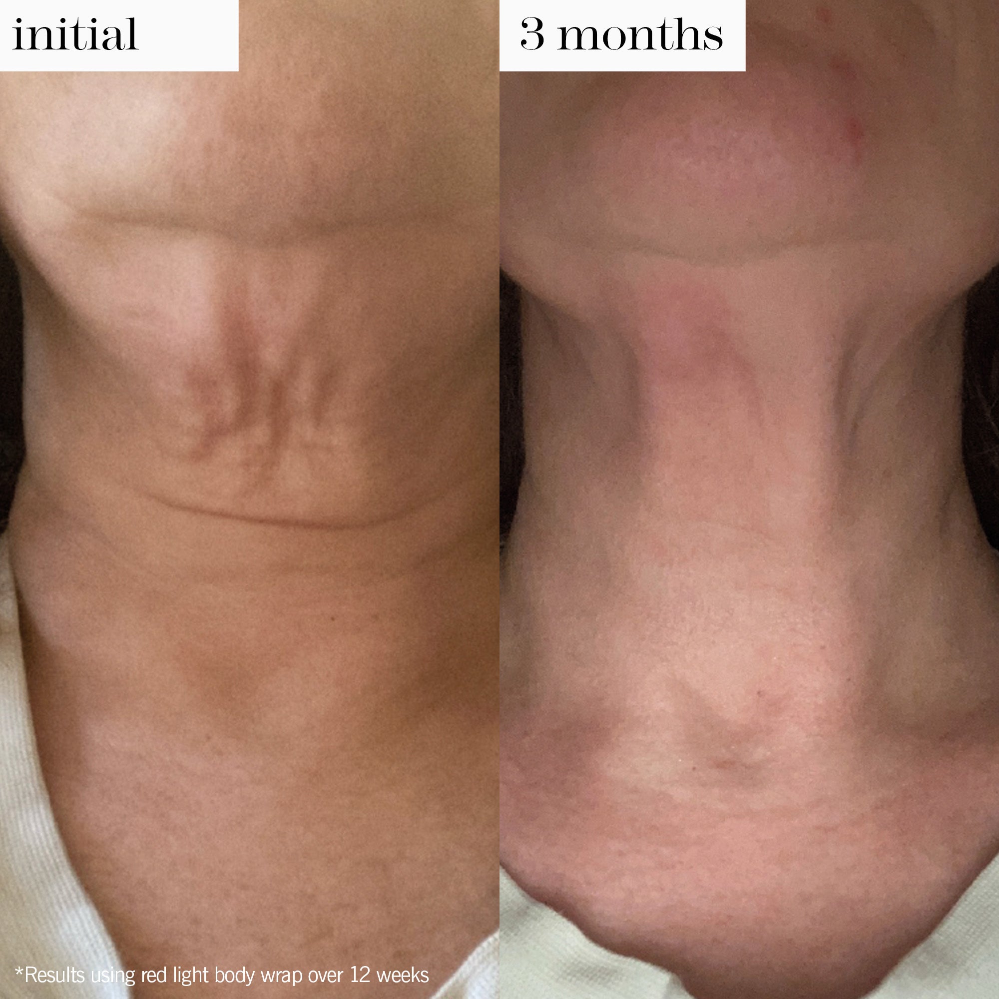 red light body wrap duo