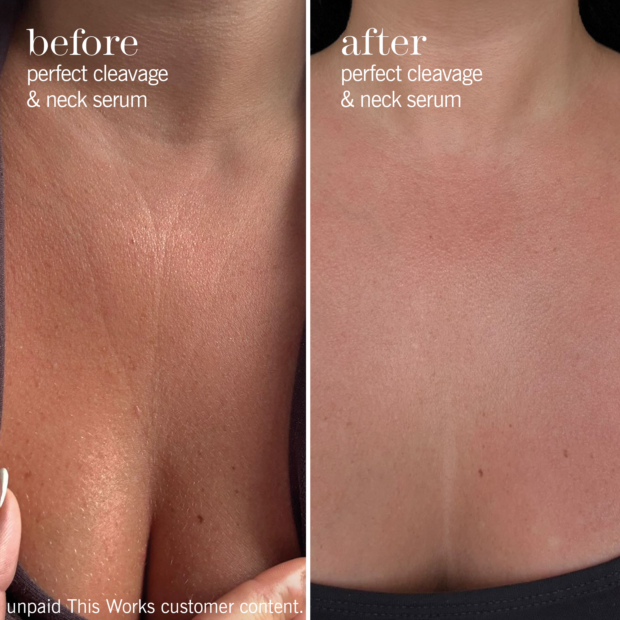 camera-ready neck & décolletage set