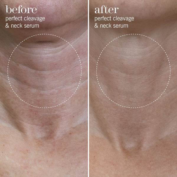 perfect cleavage &amp neck serum