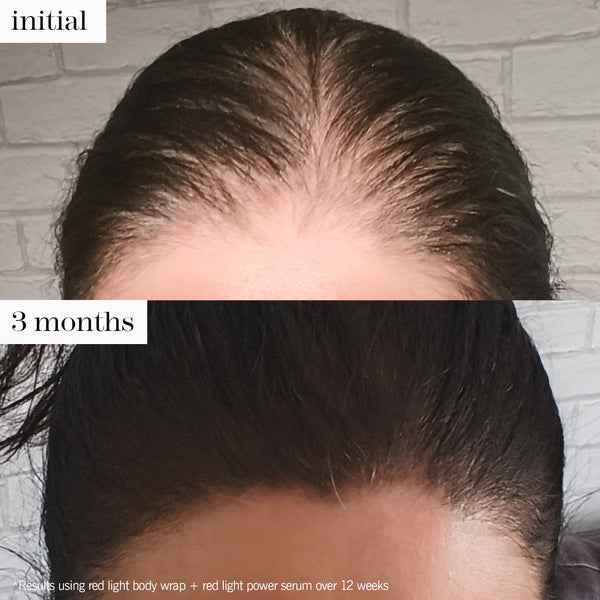 light power serum