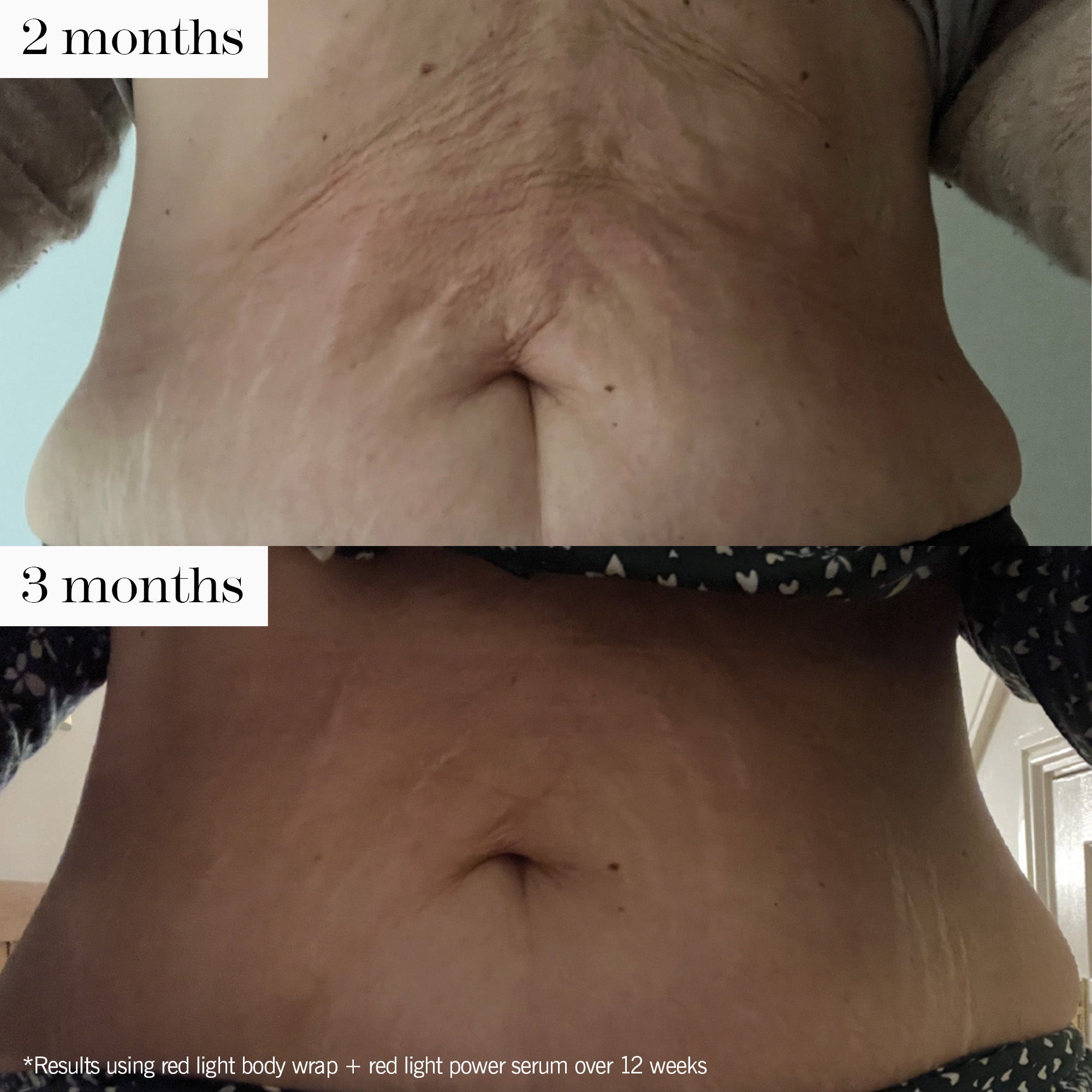 advanced red light system